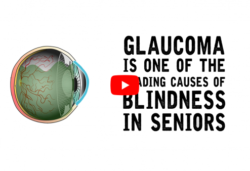 What It Looks Like! Glaucoma